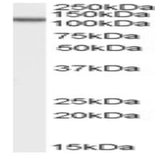 anti-Oxysterol Binding Protein-Like 5 (OSBPL5) (N-Term) antibody avatar