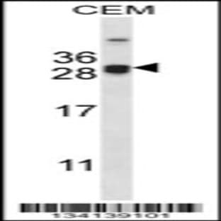 anti-Cell Death-Inducing DFFA-Like Effector A (CIDEA) (C-Term), (AA 181-209) antibody avatar