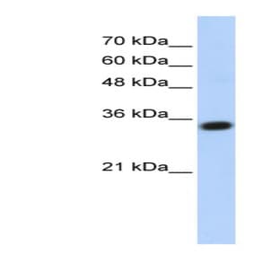 anti-Complement C1q Tumor Necrosis Factor-Related Protein 4 (C1QTNF4) (Middle Region) antibody avatar