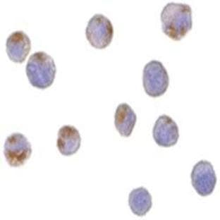 anti-Complement C1q Tumor Necrosis Factor-Related Protein 6 (C1QTNF6) (C-Term) antibody avatar