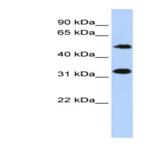 anti-Chromosome 6 Open Reading Frame 150 (C6orf150) (Middle Region) antibody avatar