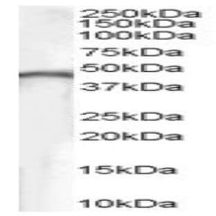 anti-Creatine Kinase, Brain (CKB) (Internal Region) antibody avatar