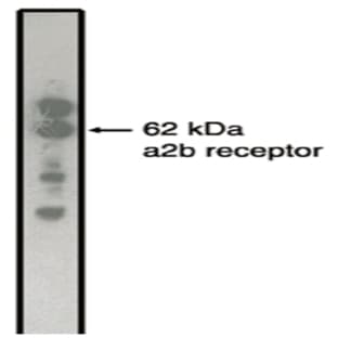 anti-Adrenergic, alpha-2B-, Receptor (ADRA2B) antibody avatar