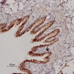 anti-Adrenergic, beta-2-, Receptor, Surface (ADRB2) (N-Term), (AA 15-30), (Extracellular Loop) antibody avatar