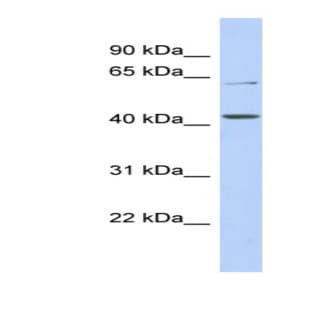 anti-Solute Carrier Family 22 (Organic Anion/urate Transporter), Member 12 (SLC22A12) (N-Term) antibody avatar