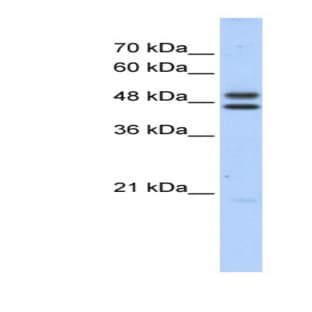 anti-Excision Repair Cross-Complementing Rodent Repair Deficiency, Complementation Group 8 (ERCC8) (Middle Region) antibody avatar