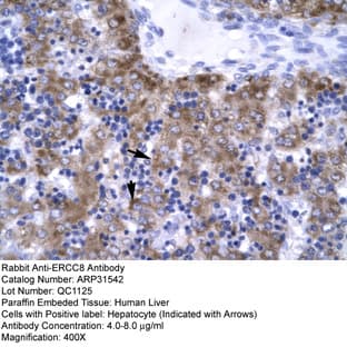 anti-Excision Repair Cross-Complementing Rodent Repair Deficiency, Complementation Group 8 (ERCC8) (C-Term) antibody avatar