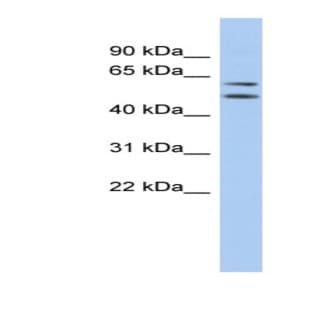 anti-Abhydrolase Domain Containing 15 (ABHD15) (N-Term) antibody avatar