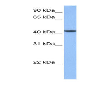 anti-Chromosome 8 Open Reading Frame 34 (C8orf34) (N-Term) antibody avatar