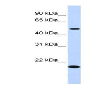 anti-Chromosome 5 Open Reading Frame 55 (C5orf55) (N-Term) antibody avatar