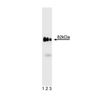anti-A Kinase (PRKA) Anchor Protein 4 (AKAP4) (AA 555-675) antibody avatar