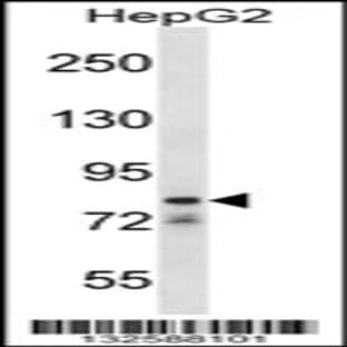 anti-Cation Channel, Sperm Associated 1 (CATSPER1) (N-Term), (AA 36-65) antibody avatar