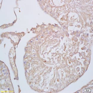 anti-Cation Channel, Sperm Associated 1 (CATSPER1) antibody avatar