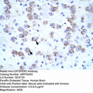 anti-Cation Channel, Sperm Associated 2 (CATSPER2) (N-Term) antibody avatar