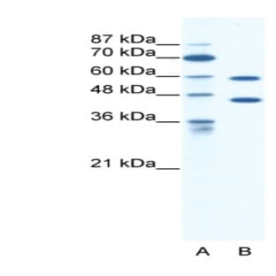 anti-Cation Channel, Sperm Associated 2 (CATSPER2) (C-Term) antibody avatar