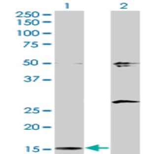 anti-Adaptor-Related Protein Complex 2, sigma 1 Subunit (AP2S1) (AA 1-143) antibody avatar