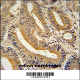 anti-Adaptor-Related Protein Complex 3, sigma 1 Subunit (AP3S1) (N-Term), (AA 1-30) antibody avatar