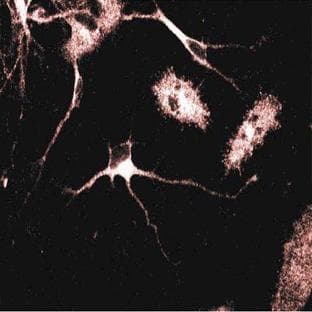 anti-Adaptor-Related Protein Complex 1, gamma 1 Subunit (AP1G1) (AA 642-821) antibody avatar