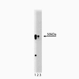 anti-Adaptor-Related Protein Complex 2, mu 1 Subunit (AP2M1) (AA 110-230) antibody avatar