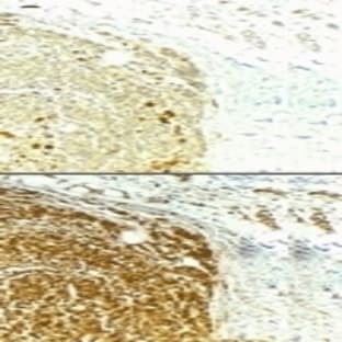 anti-Baculoviral IAP Repeat-Containing 5 (BIRC5) antibody avatar