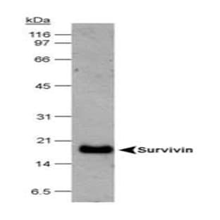 anti-Baculoviral IAP Repeat-Containing 5 (BIRC5) antibody avatar