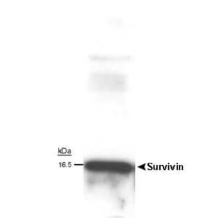anti-Baculoviral IAP Repeat-Containing 5 (BIRC5) antibody avatar