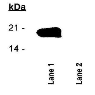 anti-Baculoviral IAP Repeat-Containing 5 (BIRC5) antibody avatar