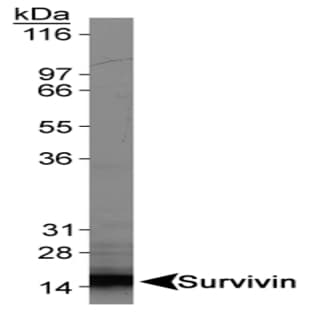 anti-Baculoviral IAP Repeat-Containing 5 (BIRC5) antibody avatar