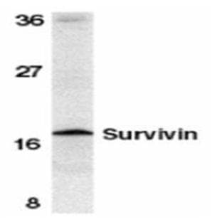 anti-Baculoviral IAP Repeat-Containing 5 (BIRC5) (AA 128-140), (C-Term) antibody avatar