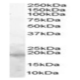 anti-Baculoviral IAP Repeat-Containing 5 (BIRC5) (C-Term) antibody avatar