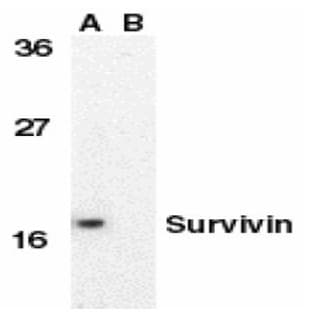 anti-Baculoviral IAP Repeat-Containing 5 (BIRC5) (C-Term) antibody avatar