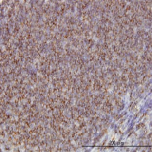 anti-Adducin 1 (Alpha) (ADD1) (AA 1-663) antibody avatar