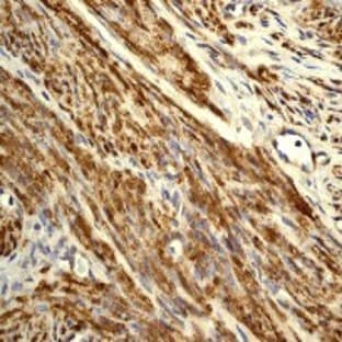 anti-Adducin 1 (Alpha) (ADD1) (Ser481) antibody avatar