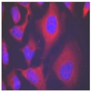 anti-Adducin 1 (Alpha) (ADD1) (pSer726) antibody avatar