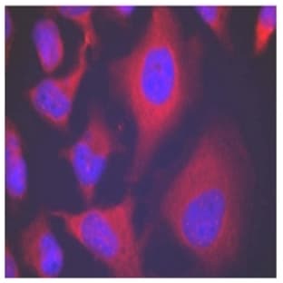 anti-Adducin 1 (Alpha) (ADD1) (pSer726) antibody avatar