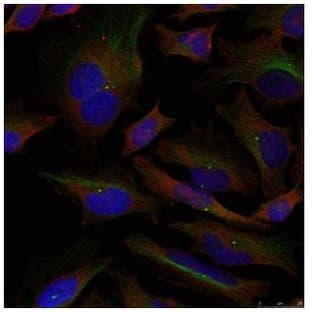 anti-Adducin 1 (Alpha) (ADD1) (Ser726) antibody avatar