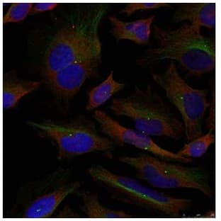 anti-Adducin 1 (Alpha) (ADD1) (Ser726) antibody avatar