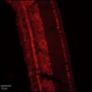 anti-Chloride Channel 4 (CLCN4) (C-Term), (AA 663-689) antibody avatar
