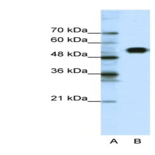 anti-Chloride Channel Kb (CLCNKB) (N-Term) antibody avatar