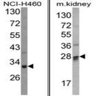 anti-Catechol-O-Methyltransferase Domain Containing 1 (COMTD1) (C-Term) antibody avatar
