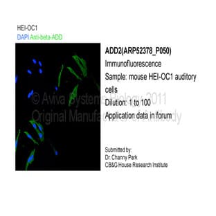 anti-Adducin 2 (Beta) (ADD2) (Middle Region) antibody avatar
