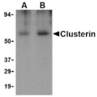 anti-Clusterin (CLU) (Isoform 1) antibody avatar
