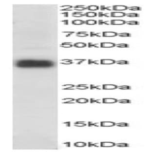 anti-Clusterin (CLU) (C-Term) antibody avatar