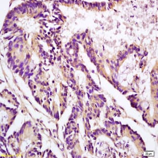 anti-Clusterin (CLU) antibody avatar