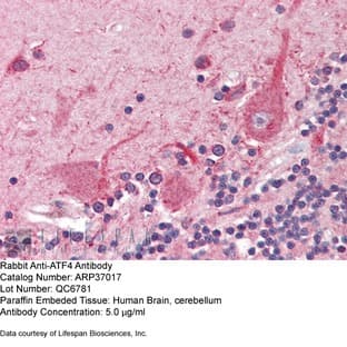 anti-Activating Transcription Factor 4 (Tax-Responsive Enhancer Element B67) (ATF4) (N-Term) antibody avatar