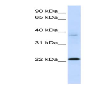 anti-Chromosome 11 Open Reading Frame 74 (C11ORF74) (Middle Region) antibody avatar