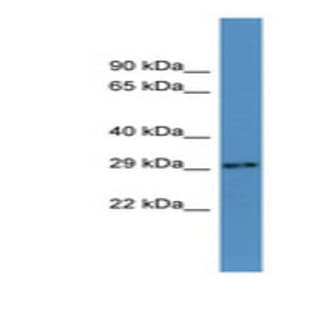 anti-AU RNA Binding Protein/enoyl-CoA Hydratase (AUH) (N-Term) antibody avatar