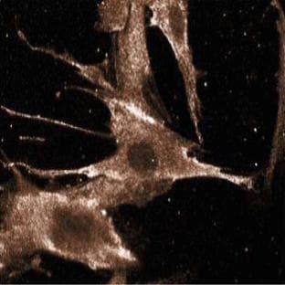 anti-BCL2-Associated Agonist of Cell Death (BAD) (AA 39-198) antibody avatar