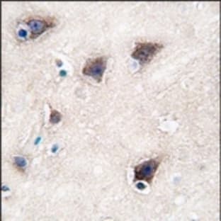 anti-Cytochrome P450, Family 2, Subfamily R, Polypeptide 1 (CYP2R1) (C-Term) antibody avatar