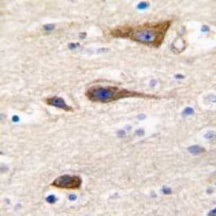 anti-Cytochrome P450, Family 2, Subfamily R, Polypeptide 1 (CYP2R1) (Middle Region) antibody avatar